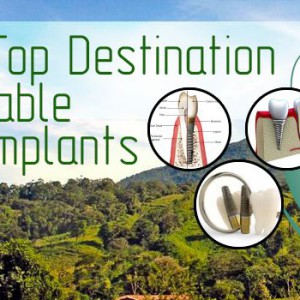 Costa Rica - Top Destination For Affordable Dental Implants